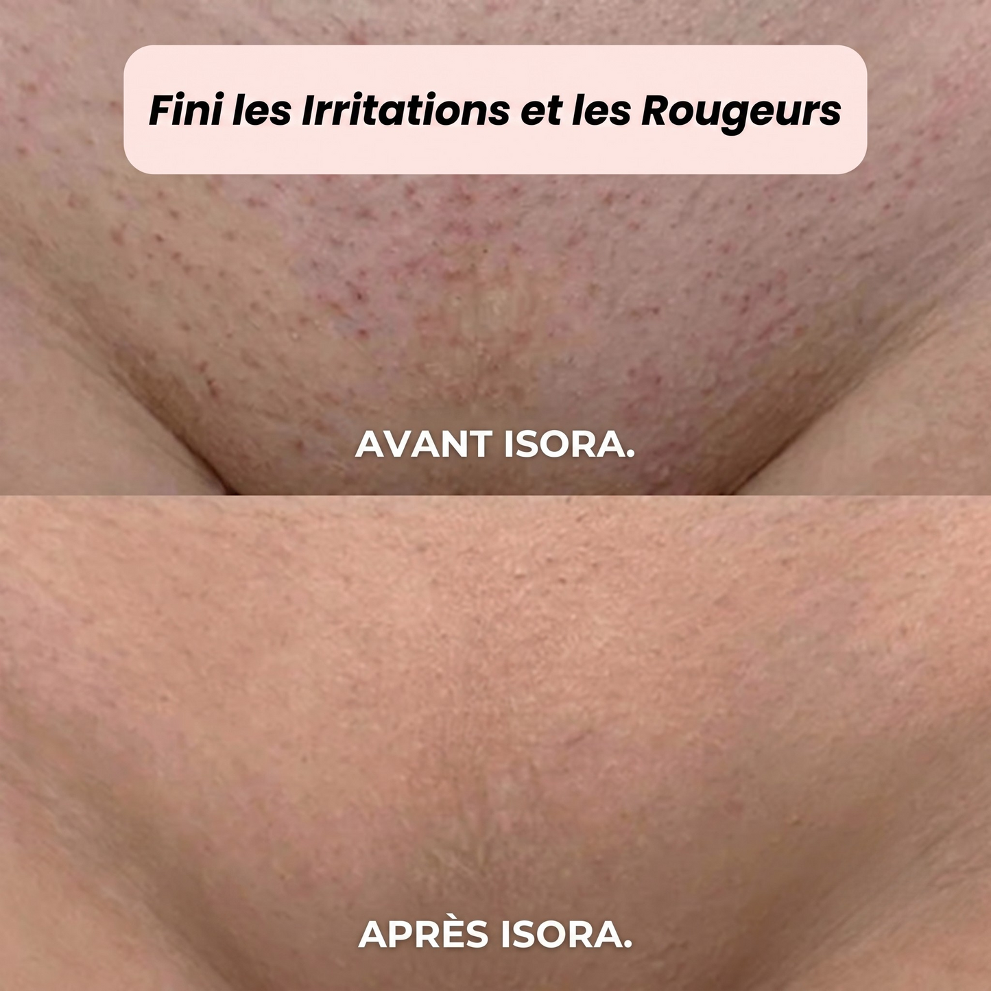Rasoir 2-en-1 pour le maillot et le corps Isora