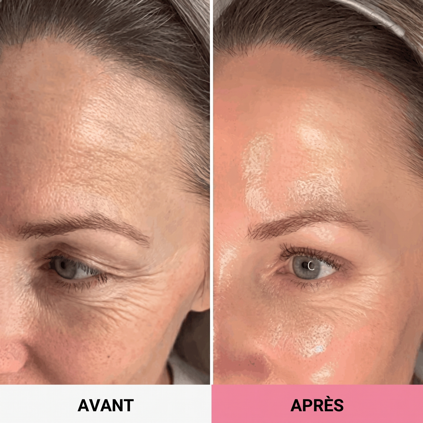 Baume Volume Collagène PDRN
